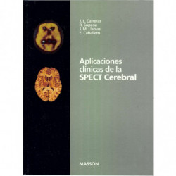 APLICACIONES CLINICAS DE LA SPECT CEREBRAL